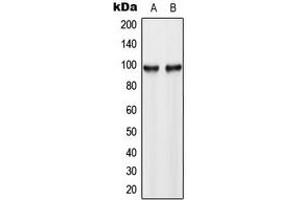 Western blot analysis of Hexokinase 3 expression in HL60 (A), HeLa (B) whole cell lysates. (HK3 抗体  (C-Term))