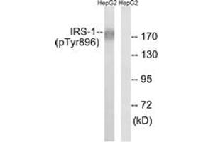 Western blot analysis of extracts from HepG2 cells treated with Na3VO4 0. (IRS1 抗体  (pTyr896))