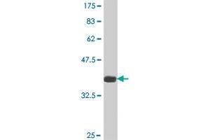 Western Blot detection against Immunogen (36. (HOXD1 抗体  (AA 151-240))