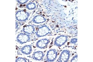 Immunohistochemistry of paraffin-embedded human colon using Mast Cell Tryptase (TPSB2) (TPSB2) Rabbit mAb (ABIN7271017) at dilution of 1:100 (40x lens). (TPSB2 抗体)