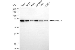 Western blotting analysis using DYRK1B antibody (ABIN7798391).