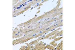 Immunohistochemistry of paraffin-embedded rat heart using NSF antibody (ABIN5974702) at dilution of 1/100 (40x lens). (NSF 抗体)