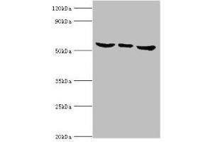 Western blot All lanes: MAPK15 antibody at 6 μg/mL Lane 1: Hela whole cell lysate Lane 2: MCF-7 whole cell lysate Lane 3: HepG2 whole cell lysate Secondary Goat polyclonal to rabbit IgG at 1/10000 dilution Predicted band size: 60, 29, 32 kDa Observed band size: 60 kDa (MAPK15 抗体  (AA 1-95))