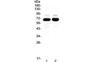 Western blot testing of 1) rat brain and 2) mouse brain lysate with SF1 antibody at 0. (Splicing Factor 1 抗体)