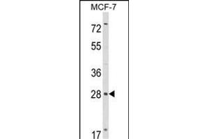 Western blot analysis of RASL11B Antibody (N-term) (ABIN652737 and ABIN2842488) in MCF-7 cell line lysates (35 μg/lane). (RASL11B 抗体  (N-Term))