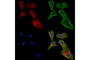 ABIN6257016 and ABIN6274443 staining Hela cells by IF/ICC. (EPS8-Like 1 抗体  (Internal Region))