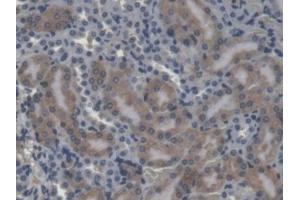 Immunohistochemistry (IHC) image for anti-Carboxylesterase 1 (CES1) (AA 31-286) antibody (ABIN5013292)