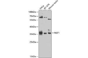 Western blot analysis of extracts of various cell lines, using MLF1 antibody (ABIN6128238, ABIN6143875, ABIN6143877 and ABIN6224035) at 1:1000 dilution. (MLF1 抗体  (AA 1-268))