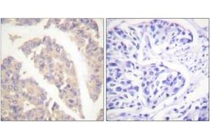 Immunohistochemistry (IHC) image for anti-Cas-Br-M (Murine) Ecotropic Retroviral Transforming Sequence (CBL) (AA 666-715) antibody (ABIN2888651) (CBL 抗体  (AA 666-715))