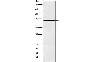 Western blot analysis of LOX12 expression in A431 cell lysate.