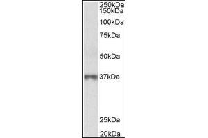 MAT2B  Antibody staining of Human Thymus lysate at 0. (MAT2B 抗体  (Isoform 1, N-Term))