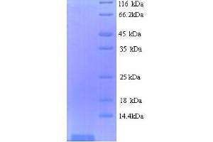 SDS-PAGE (SDS) image for Shiga Toxin Subunit B (StxB) (AA 21-89) protein (His tag) (ABIN5713960) (STXB Protein (AA 21-89) (His tag))