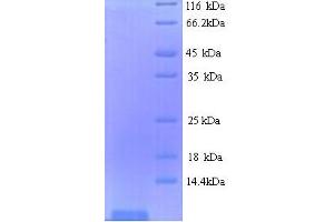 SDS-PAGE (SDS) image for Shiga Toxin Subunit B (STXB) (AA 21-89) protein (His tag) (ABIN5713960) (STXB Protein (AA 21-89) (His tag))