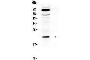 Western blot analysis of C19orf80 using anti-C19orf80 antibody . (C19ORF80 抗体  (AA 22-198))