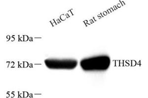 Western blot analysis of THSD4 (ABIN7075894),at dilution of 1: 2000 (Thrombospondin, Type I, Domain Containing 4 (THSD4) 抗体)