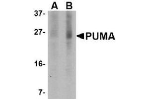 Western Blotting (WB) image for anti-BCL2 Binding Component 3 (BBC3) (AA 76-170) antibody (ABIN492518) (PUMA 抗体  (AA 76-170))