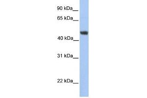 ALG2 antibody used at 1 ug/ml to detect target protein. (ALG2 抗体)