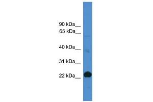 WB Suggested Anti-CD8A Antibody Titration: 0. (CD8 alpha 抗体  (Middle Region))
