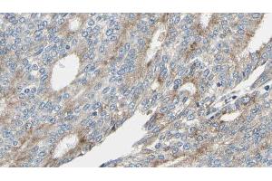 ABIN6268945 at 1/100 staining Human prostate tissue by IHC-P. (MARCKS 抗体  (Internal Region))