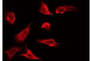 Immunofluorescence (fixed cells) (IF/ICC) image for anti-Solute Carrier Family 24 (Sodium/potassium/calcium Exchanger), Member 4 (Slc24a4) (Internal Region) antibody (ABIN6259351)
