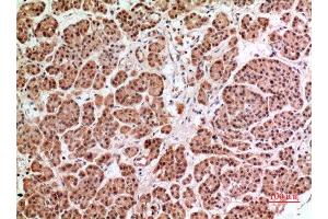 Immunohistochemistry (IHC) analysis of paraffin-embedded Human Pancreas, antibody was diluted at 1:100. (HPSE 抗体  (Internal Region))