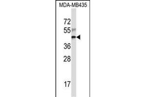 RPL3 Antibody (Center) (ABIN657323 and ABIN2846397) western blot analysis in MDA-M cell line lysates (35 μg/lane). (RPL3 抗体  (AA 224-251))