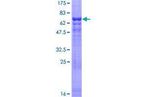 Image no. 1 for ARP6 Actin-Related Protein 6 Homolog (ACTR6) (AA 1-396) protein (GST tag) (ABIN1305789) (ACTR6 Protein (AA 1-396) (GST tag))