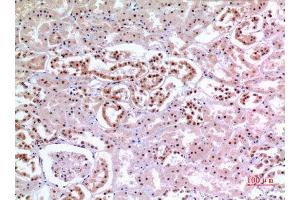 Immunohistochemistry (IHC) analysis of paraffin-embedded Human Kidney, antibody was diluted at 1:100. (XRCC6 抗体  (Ser404))