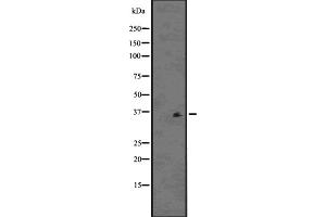 Western blot analysis of PDLIM1 using K562 whole cell lysates (PDLIM1 抗体  (Internal Region))