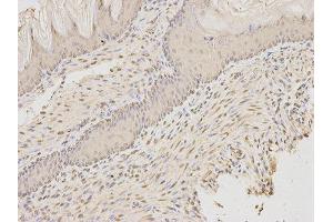 Immunohistochemistry (IHC) image for anti-Apoptosis-Inducing Factor, Mitochondrion-Associated, 1 (AIFM1) antibody (ABIN1870886) (AIF 抗体)