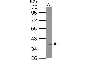 Western Blotting (WB) image for anti-TATA Box Binding Protein (TBP)-Associated Factor, RNA Polymerase I, A, 48kDa (TAF1A) (AA 1-180) antibody (ABIN1501285)