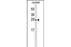 CGGBP1 Antibody (C-term) (ABIN1536689 and ABIN2849923) western blot analysis in Jurkat cell line lysates (35 μg/lane). (CGGBP1 抗体  (C-Term))