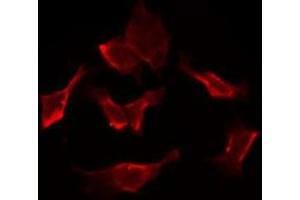 Immunofluorescence (fixed cells) (IF/ICC) image for anti-Solute Carrier Family 5 (Iodide Transporter), Member 6 (SLC5A6) (C-Term) antibody (ABIN6258560)