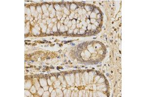 Immunohistochemistry of paraffin-embedded human colon using GLB1 antibody at dilution of 1:200 (x400 lens) (GLB1 抗体  (AA 1-270))