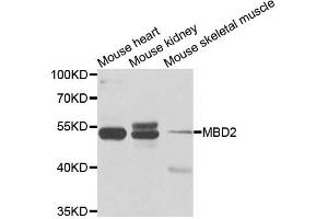 Western blot analysis of extracts of various cell lines, using MBD2 antibody. (MBD2 抗体)