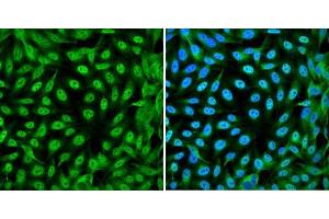 Immunofluorescence analysis of DLD-1 cells showing nuclear and cytoplasmic localization with YAP1 antibody 1:200 (left,green). (YAP1 抗体)