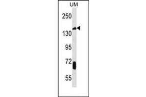 Western blot analysis of JHDM2a Antibody (C-term) in UM cell line lysates (35ug/lane). (KDM3A 抗体  (C-Term))
