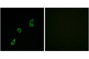 Immunofluorescence analysis of HuvEc cells, using FGF23 Antibody. (FGF23 抗体  (AA 151-200))