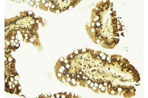 ABIN6267480 at 1/100 staining Mouse colon tissue by IHC-P.