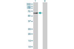 Western Blot analysis of RIPK2 expression in transfected 293T cell line by RIPK2 MaxPab polyclonal antibody. (RIPK2 抗体  (AA 1-540))