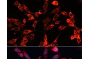 Immunofluorescence analysis of NIH-3T3 cells using MRPS28 Polyclonal Antibody at dilution of 1:100 (40x lens). (MRPS28 抗体)