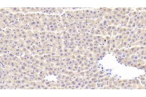 Detection of SLC in Rat Liver Tissue using Polyclonal Antibody to Secondary Lymphoid Tissue Chemokine (SLC) (CCL21 抗体  (AA 5-132))