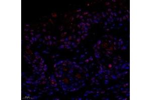 Immunofluorescence of paraffin embedded mouse skin using notch3 (ABIN7074862) at dilution of 1:650 (400x lens) (NOTCH3 抗体)