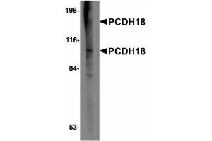 Image no. 1 for anti-Protocadherin 12 (PCDH12) (N-Term) antibody (ABIN478055) (PCDH12 抗体  (N-Term))