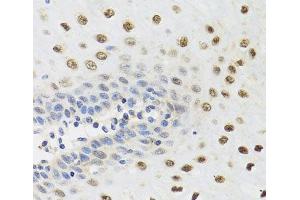 Immunohistochemistry of paraffin-embedded Human esophagus using YTHDF3 Polyclonal Antibody at dilution of 1:100 (40x lens). (YTHDF3 抗体)
