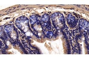 Detection of FUR in Mouse Colon Tissue using Polyclonal Antibody to Furin (FUR) (FURIN 抗体  (AA 418-573))