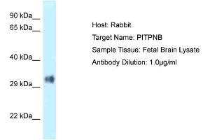 Host: Rabbit Target Name: PITPNB Sample Type: Fetal Brain lysates Antibody Dilution: 1. (PITPNB 抗体  (N-Term))
