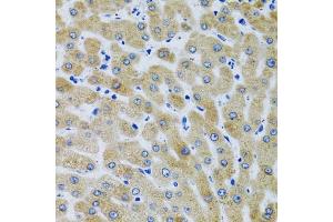Immunohistochemistry (IHC) image for anti-Mannose-Binding Lectin (Protein C) 2, Soluble (MBL2) (AA 21-248) antibody (ABIN6143597)