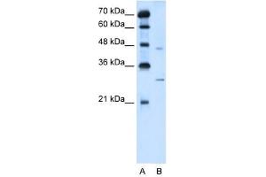 SLC36A3 antibody used at 5 ug/ml to detect target protein. (SLC36A3 抗体)