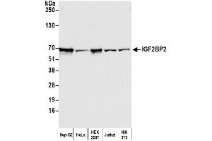 Western Blotting (WB) image for anti-Insulin-Like Growth Factor 2 mRNA Binding Protein 2 (IGF2BP2) antibody (ABIN7452649)